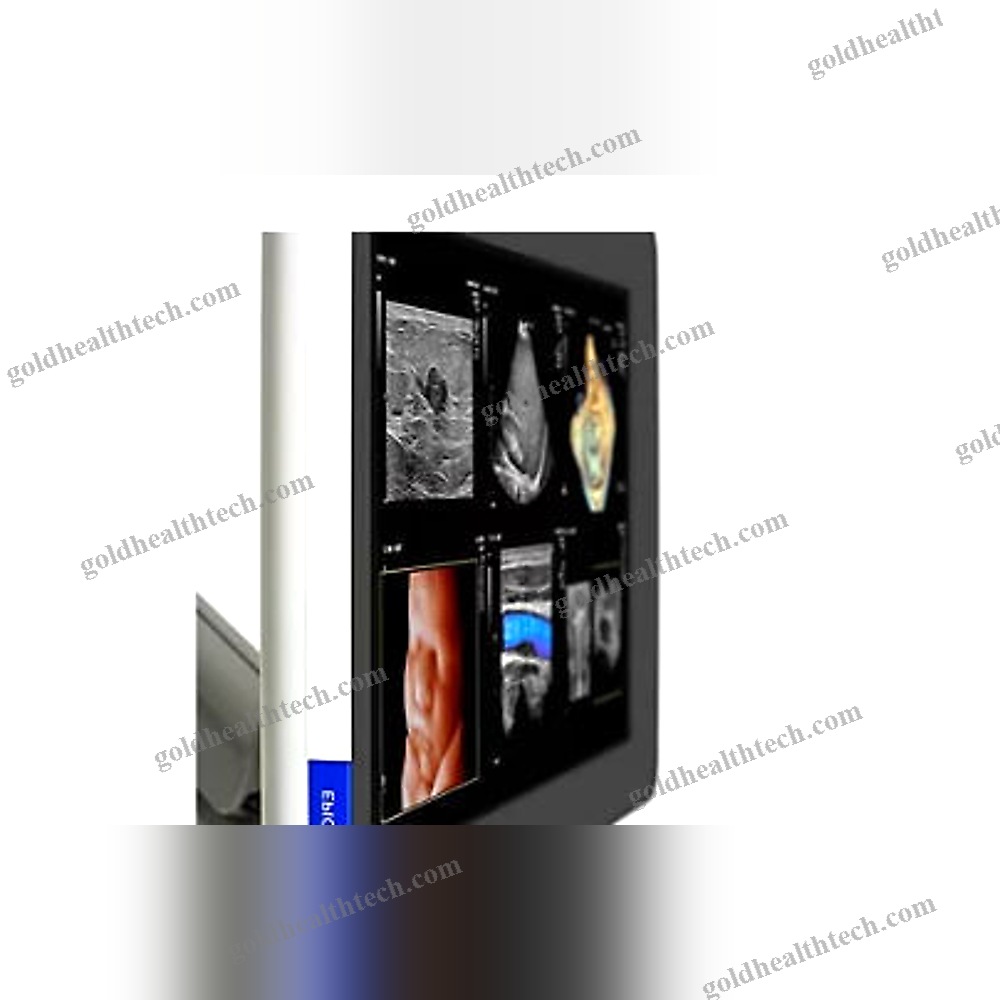 On-Platform Ultrasound System