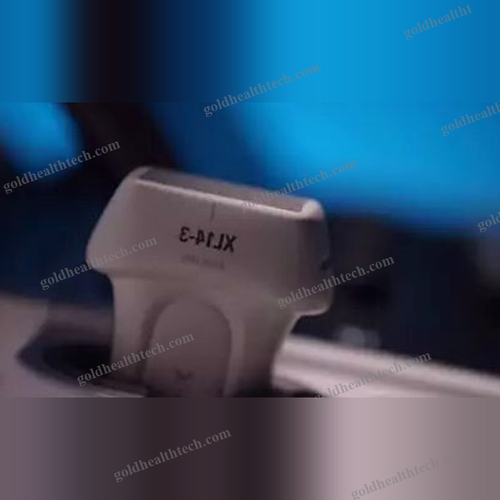 On-Platform Ultrasound System
