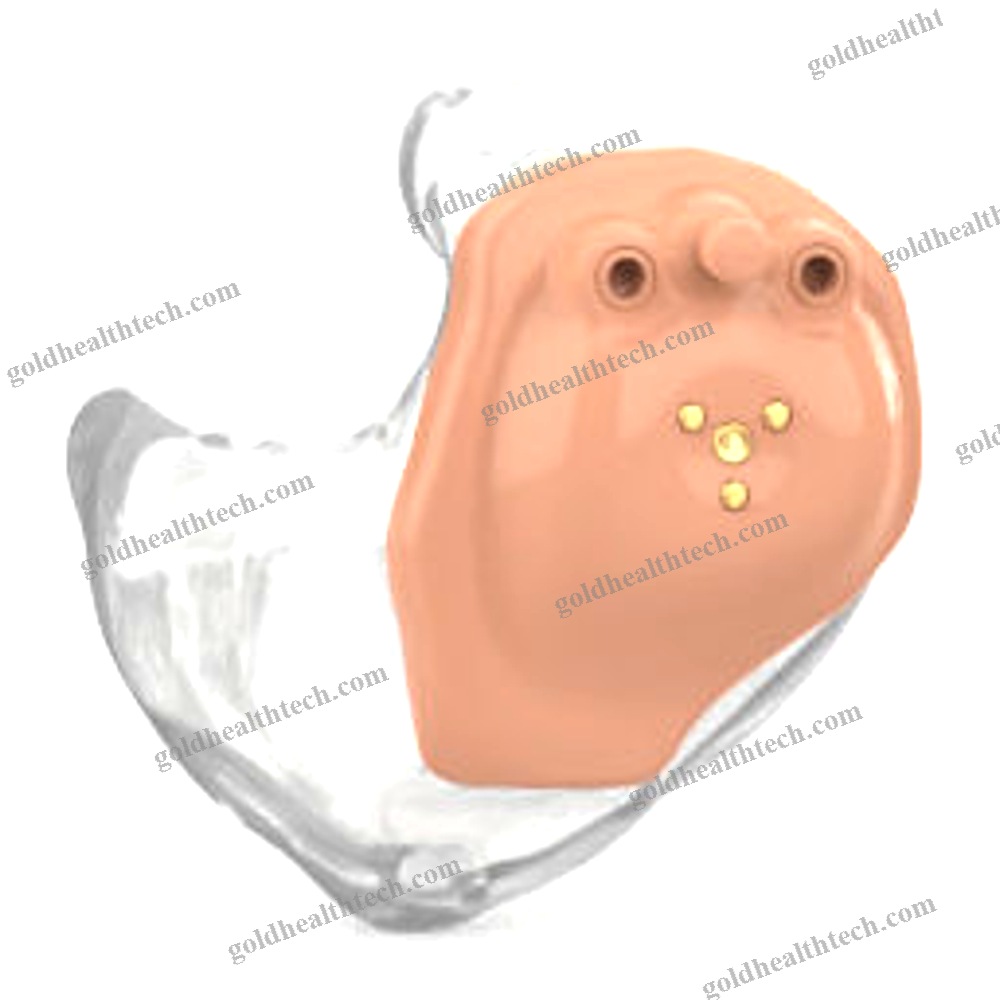 Ite Hearing Aid