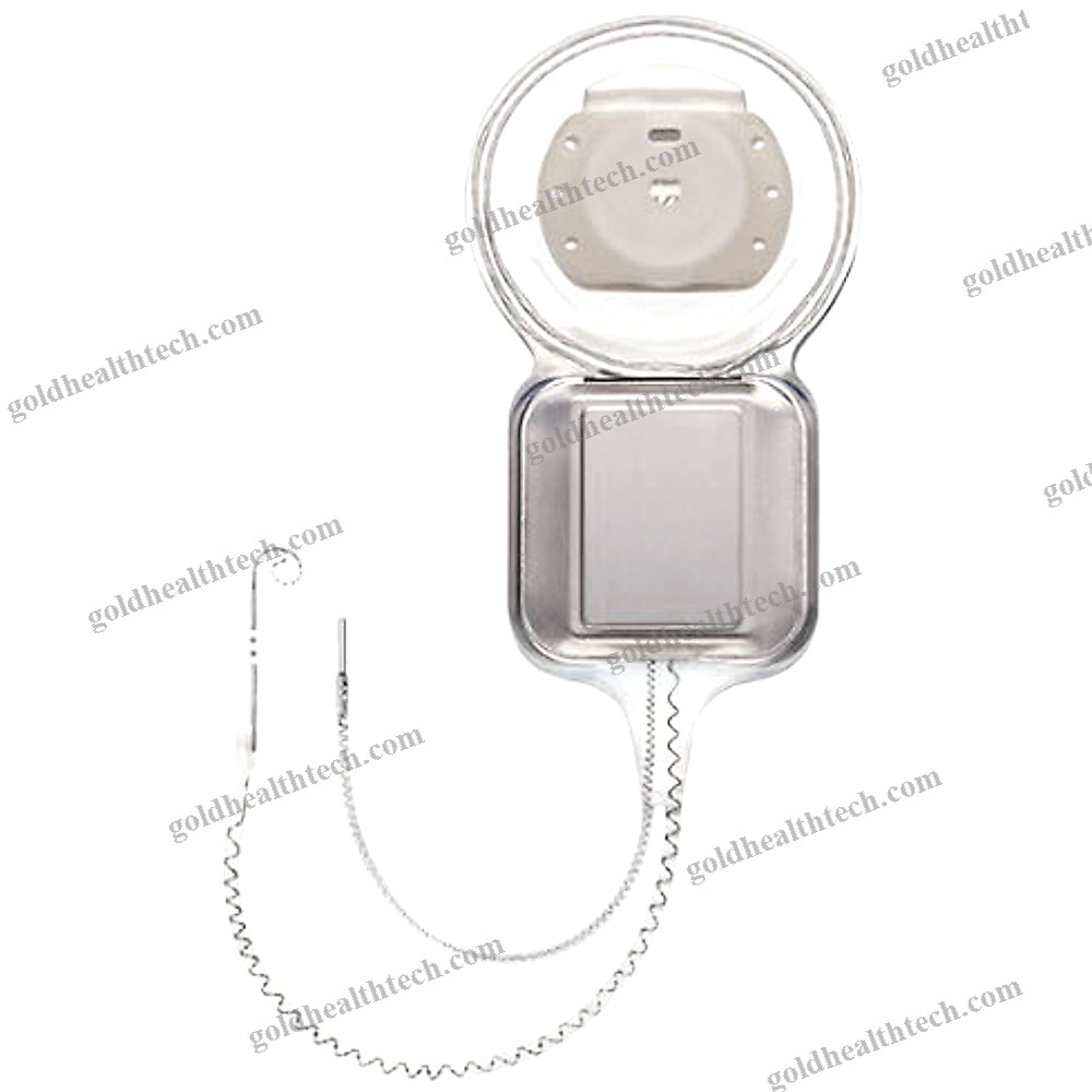 Internal Component Cochlear Implant