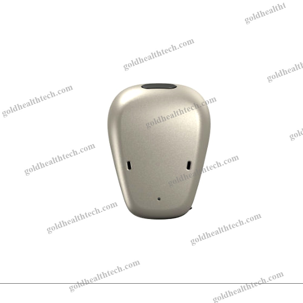 Body-Worn Processor Bone Conduction Implant