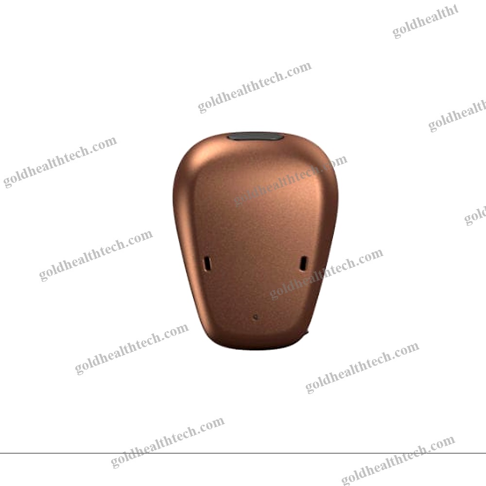 Body-Worn Processor Bone Conduction Implant