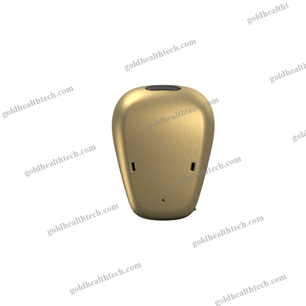 Body-Worn Processor Bone Conduction Implant