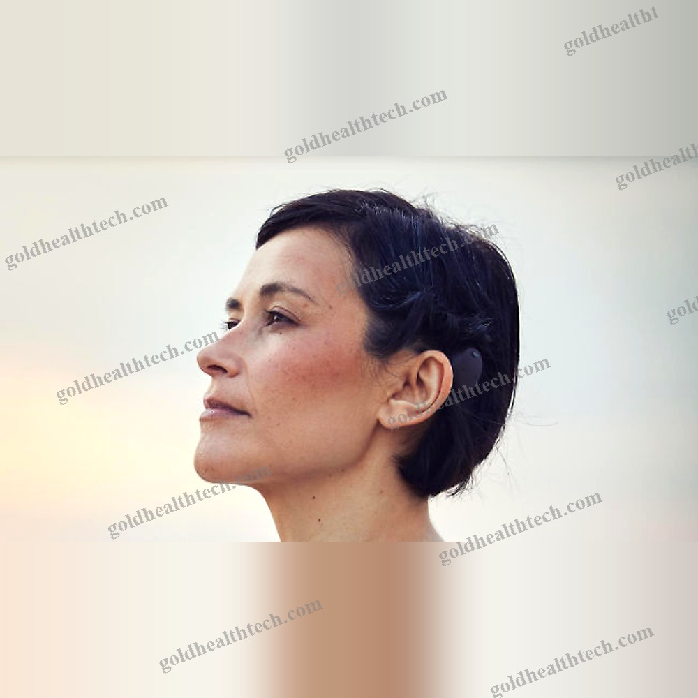 Behind-The-Ear Processor Cochlear Implant