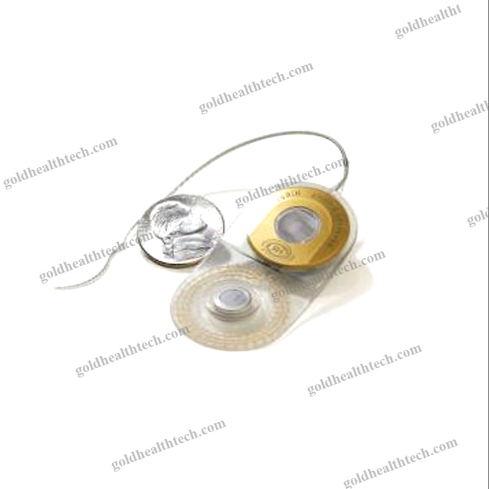 Internal Component Cochlear Implant