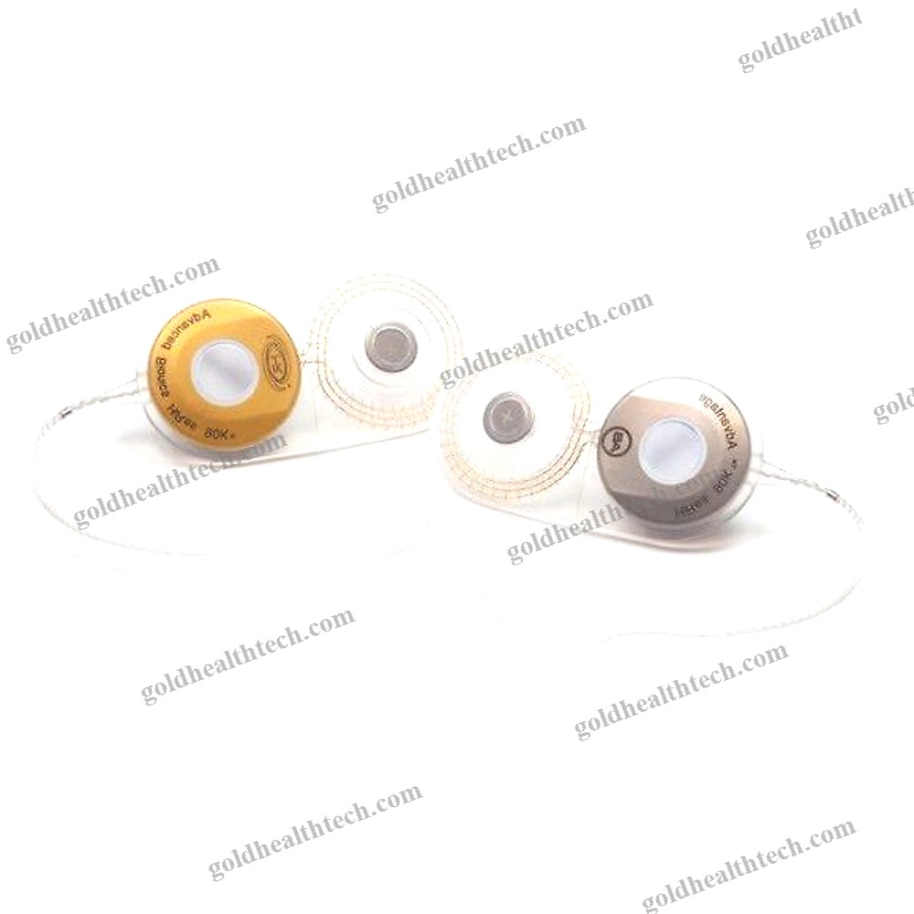 Internal Component Cochlear Implant