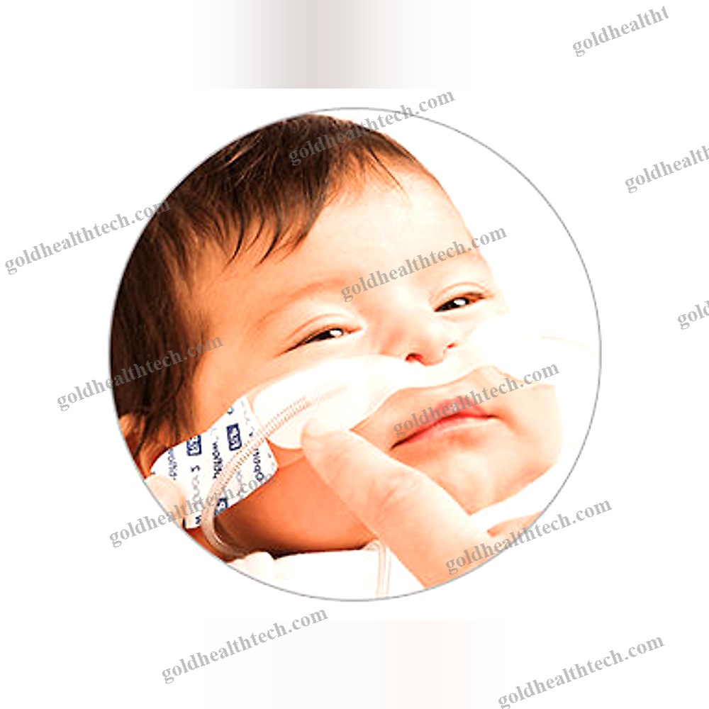 Oxygen Nasal Cannula