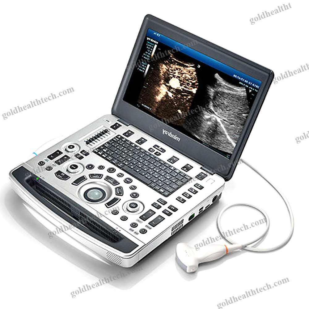 Portable, With Trolley Ultrasound System