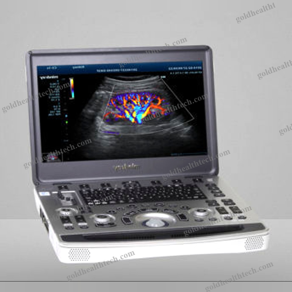 Portable, With Trolley Ultrasound System