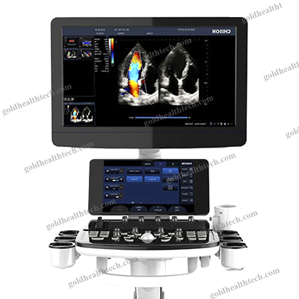 On-Platform, Compact Ultrasound System