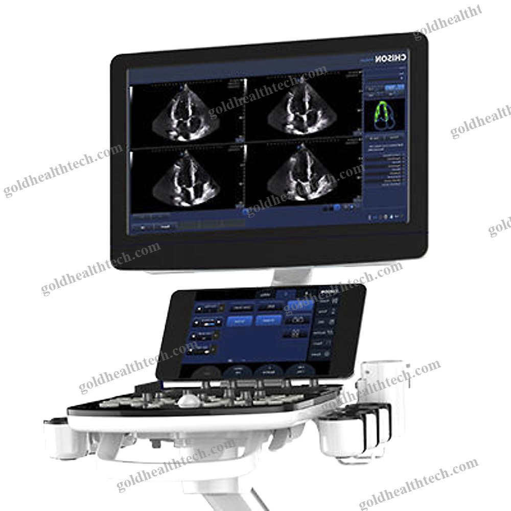 On-Platform, Compact Ultrasound System