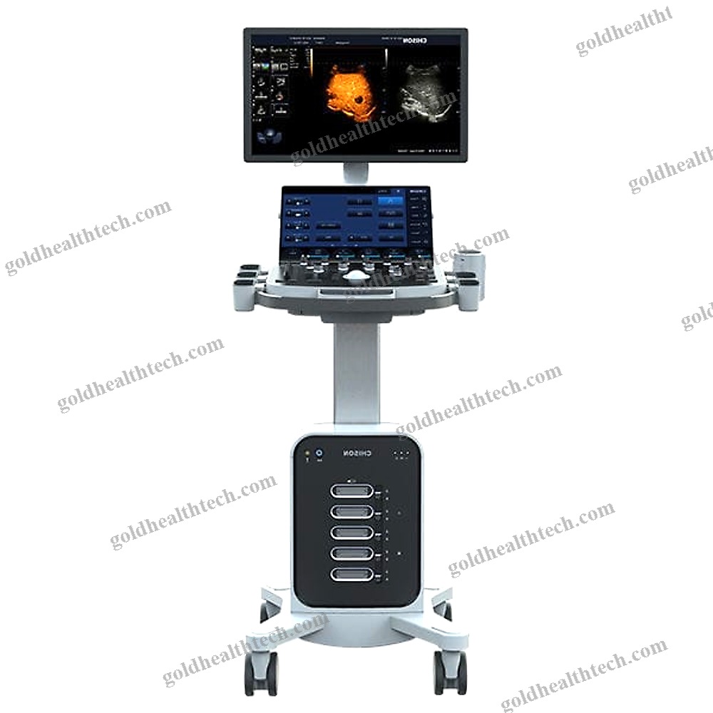 On-Platform Ultrasound System