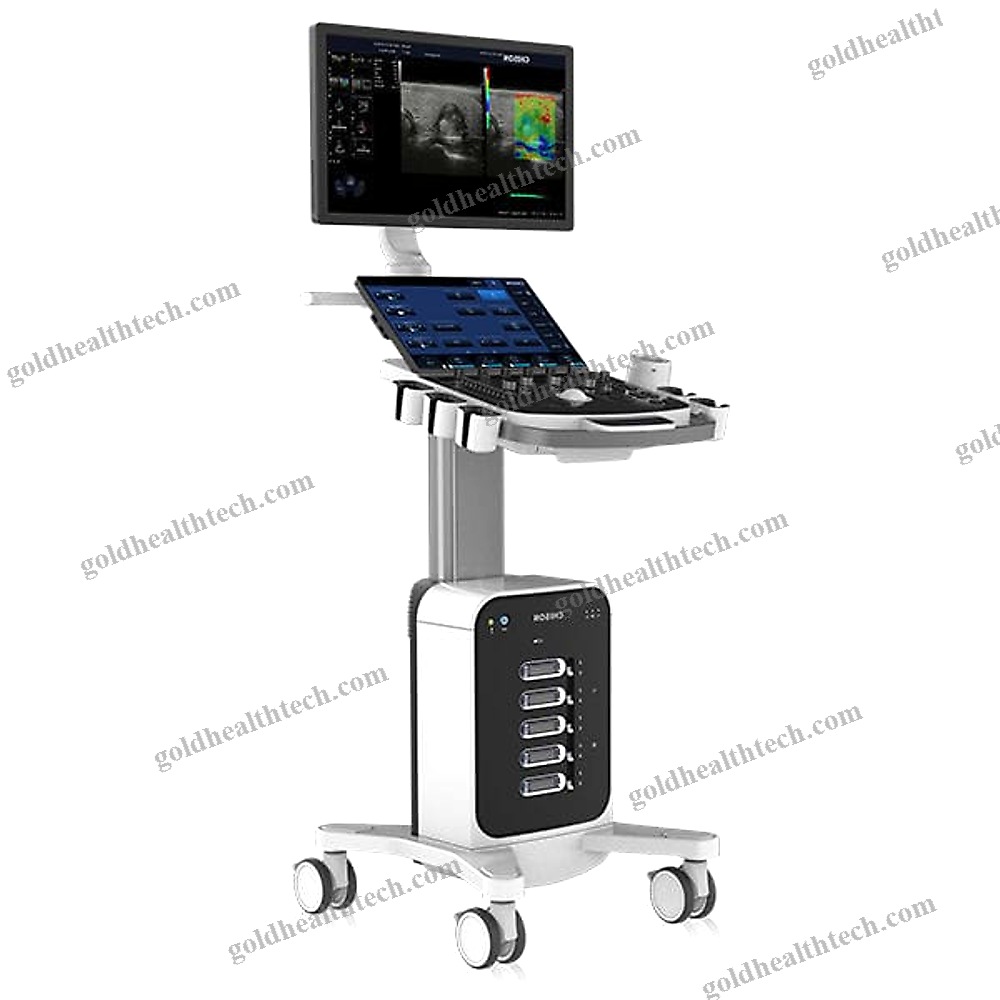 On-Platform Ultrasound System