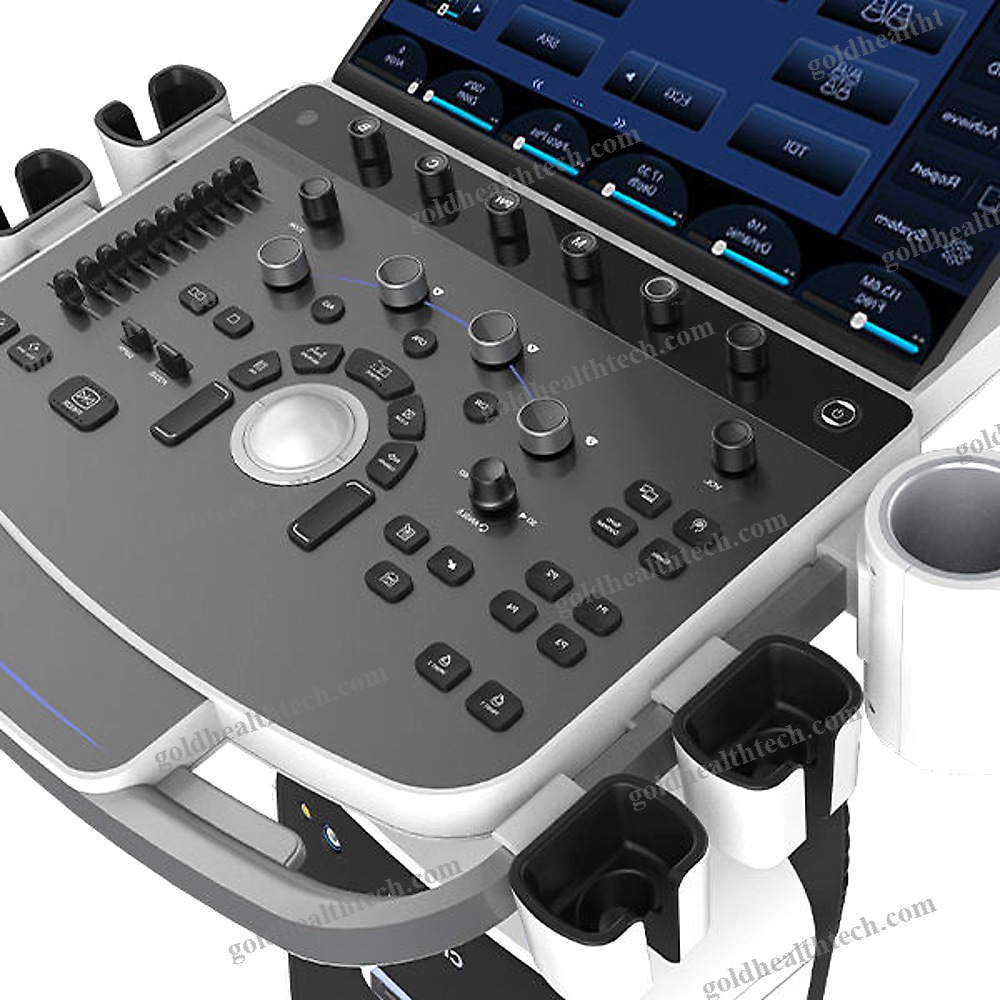 On-Platform Ultrasound System
