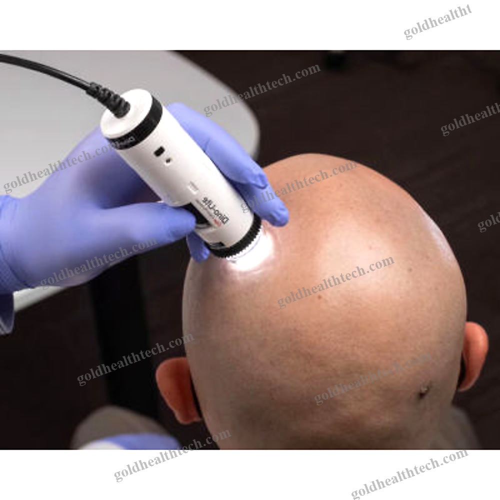 Video Trichoscope