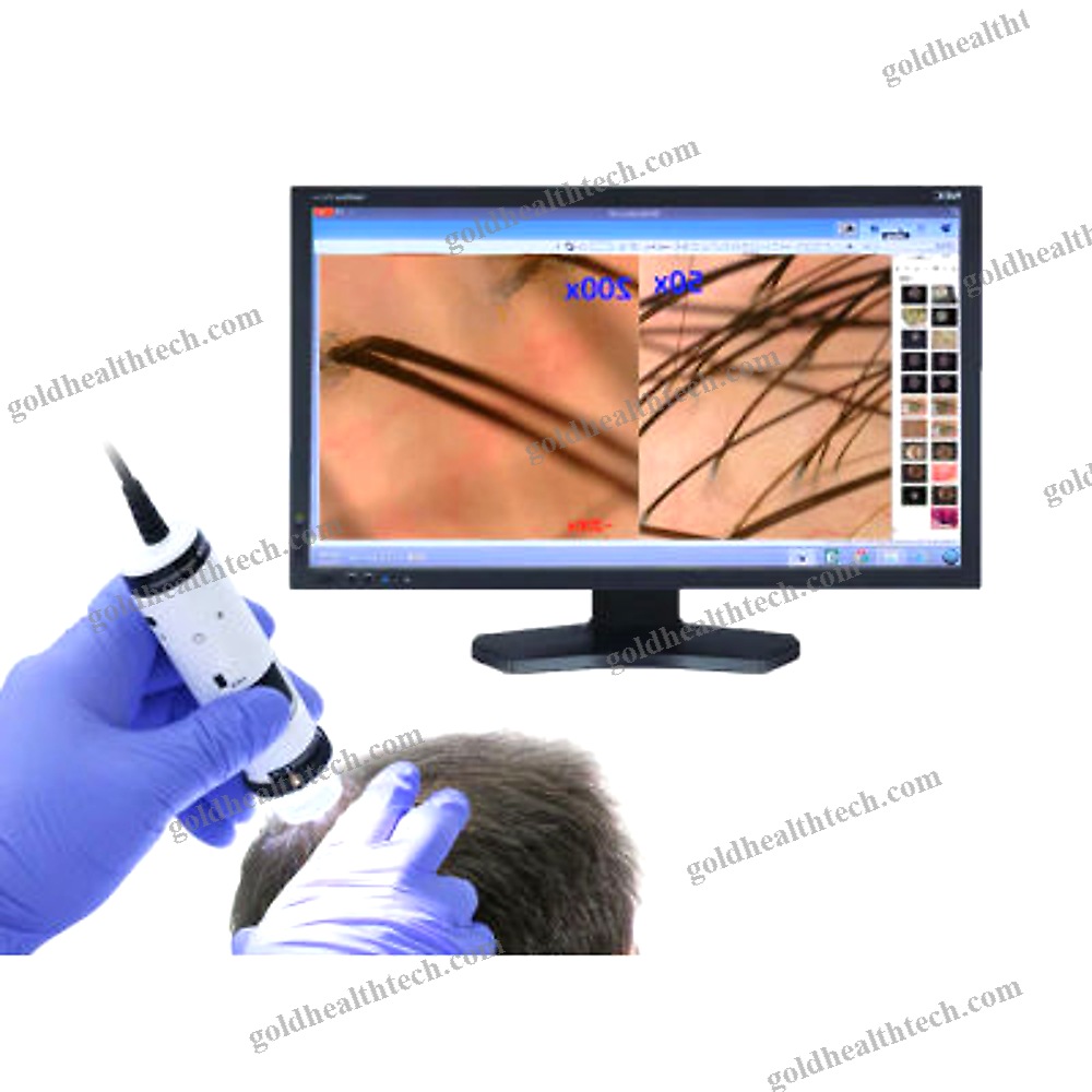 Video Trichoscope