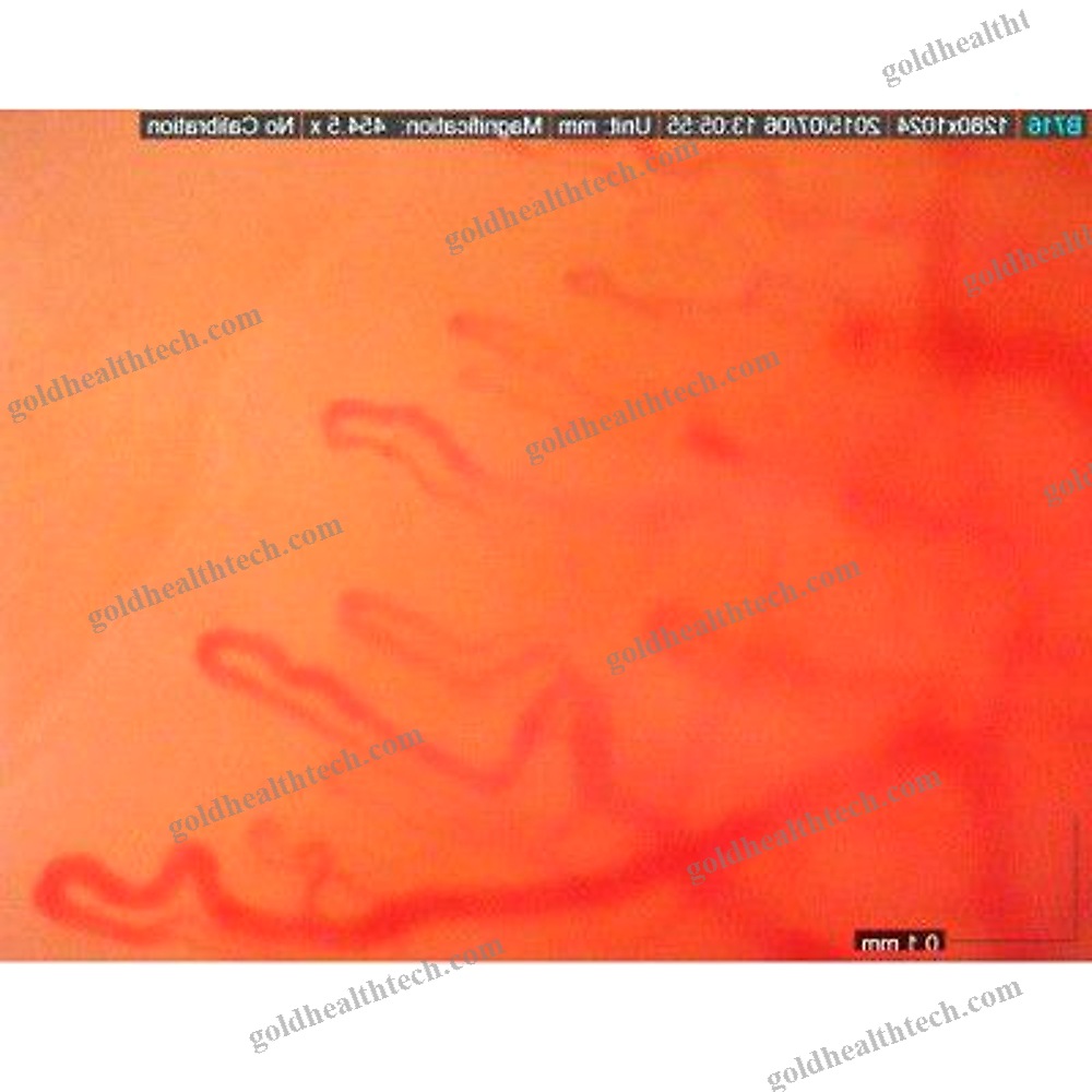 Video Capillaroscope