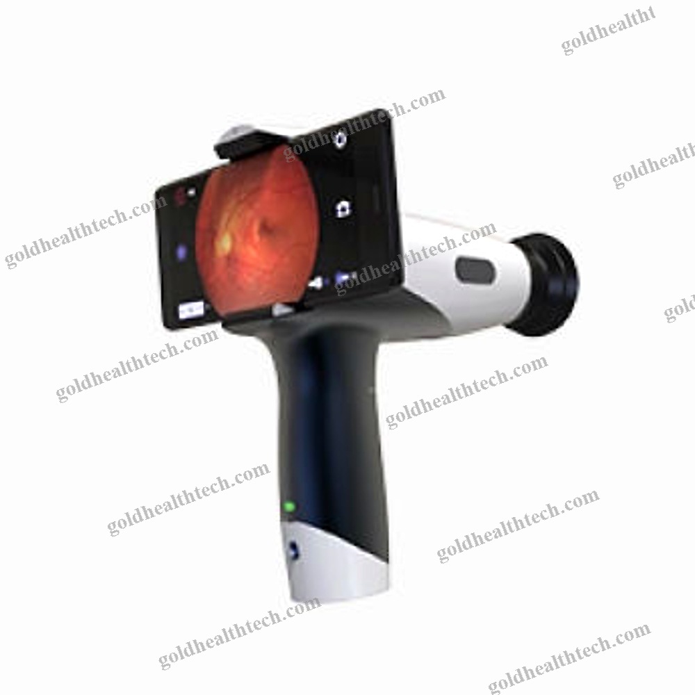 Non-Mydriatic Retinal Camera