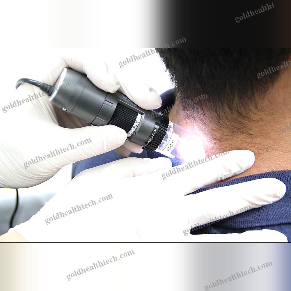 Video Dermatoscope