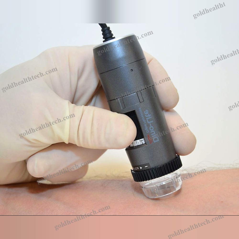 Video Dermatoscope