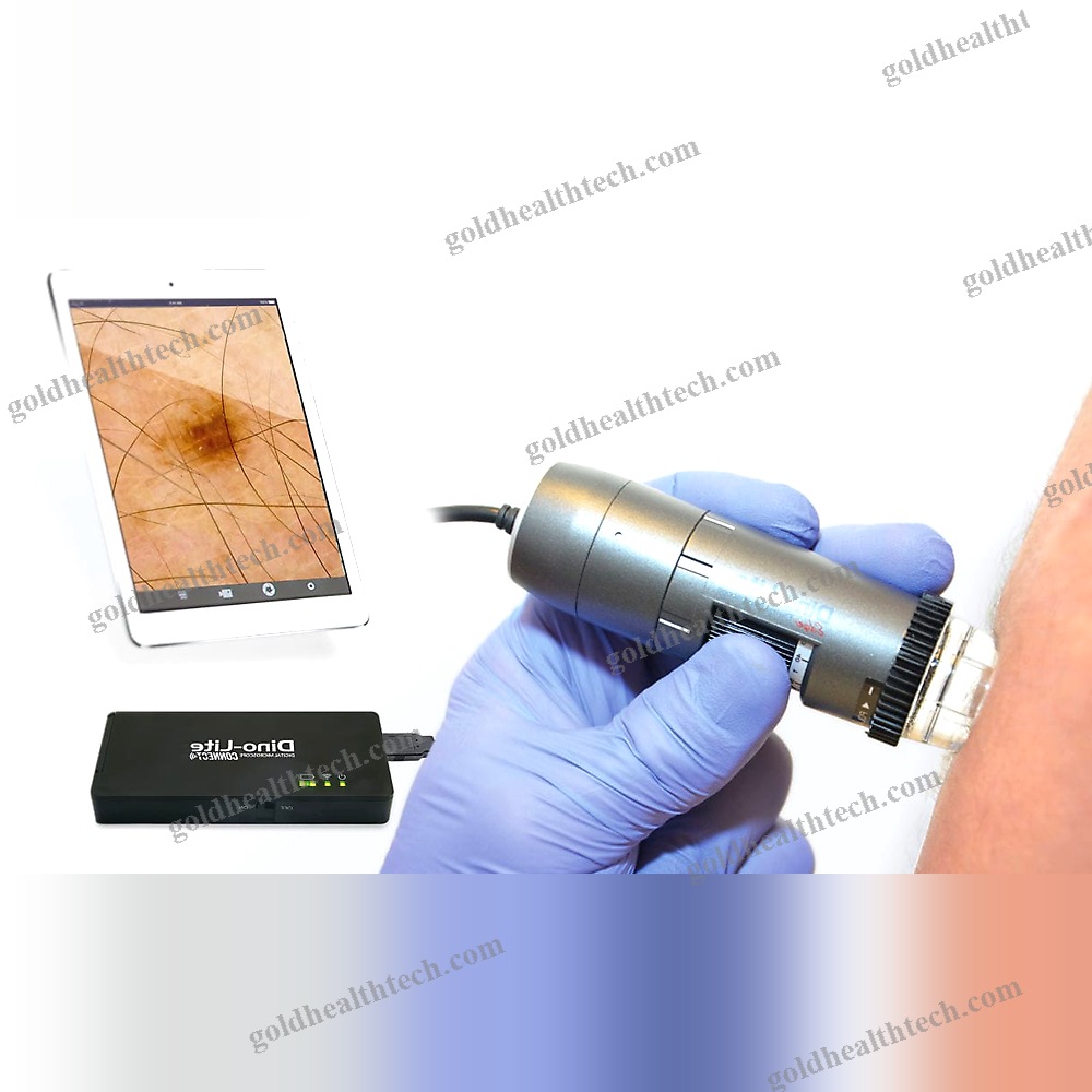 Video Dermatoscope