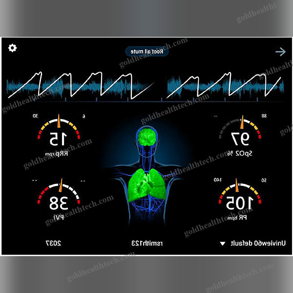 Intensive Care Display