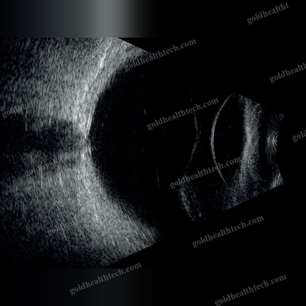 On-Platform, Tabletop Ultrasound System