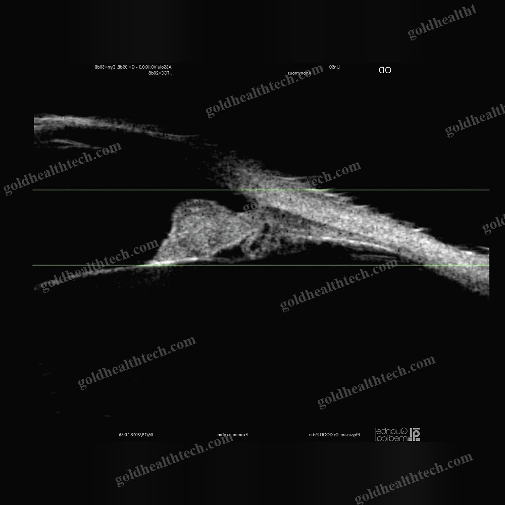 On-Platform, Tabletop Ultrasound System