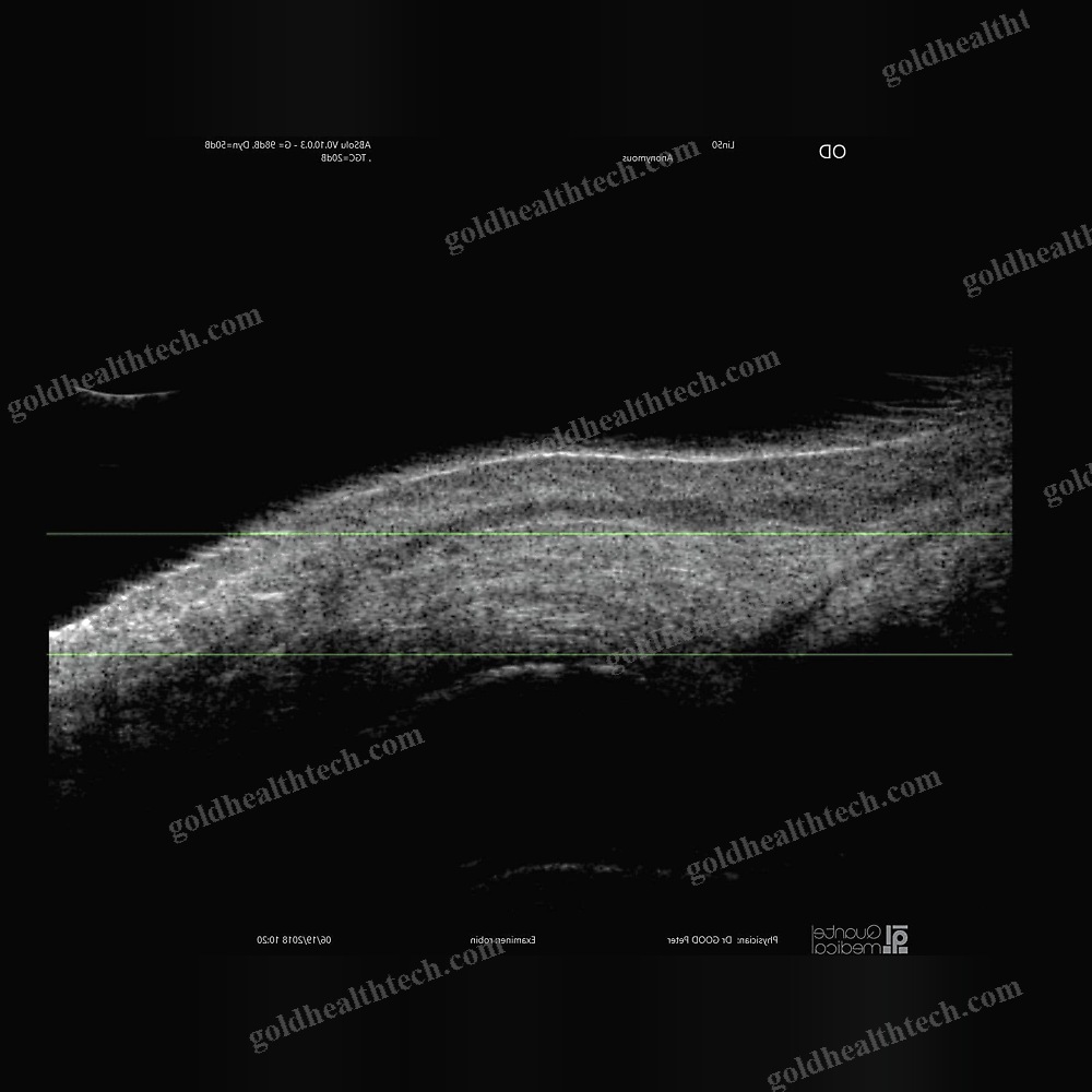 On-Platform, Tabletop Ultrasound System