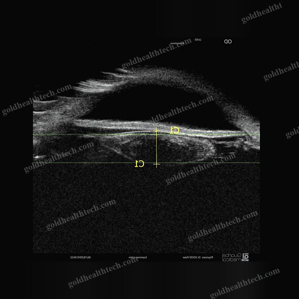 On-Platform, Tabletop Ultrasound System