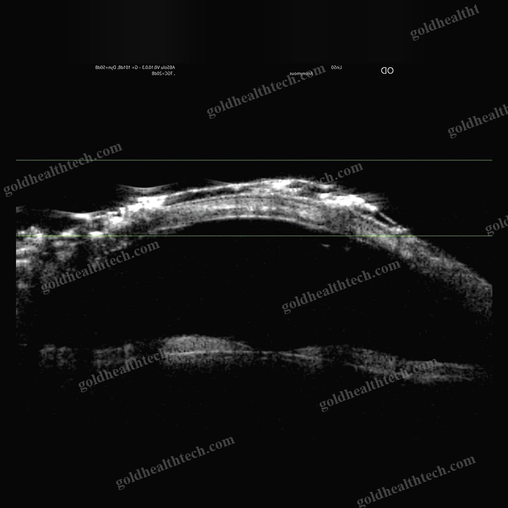 On-Platform, Tabletop Ultrasound System