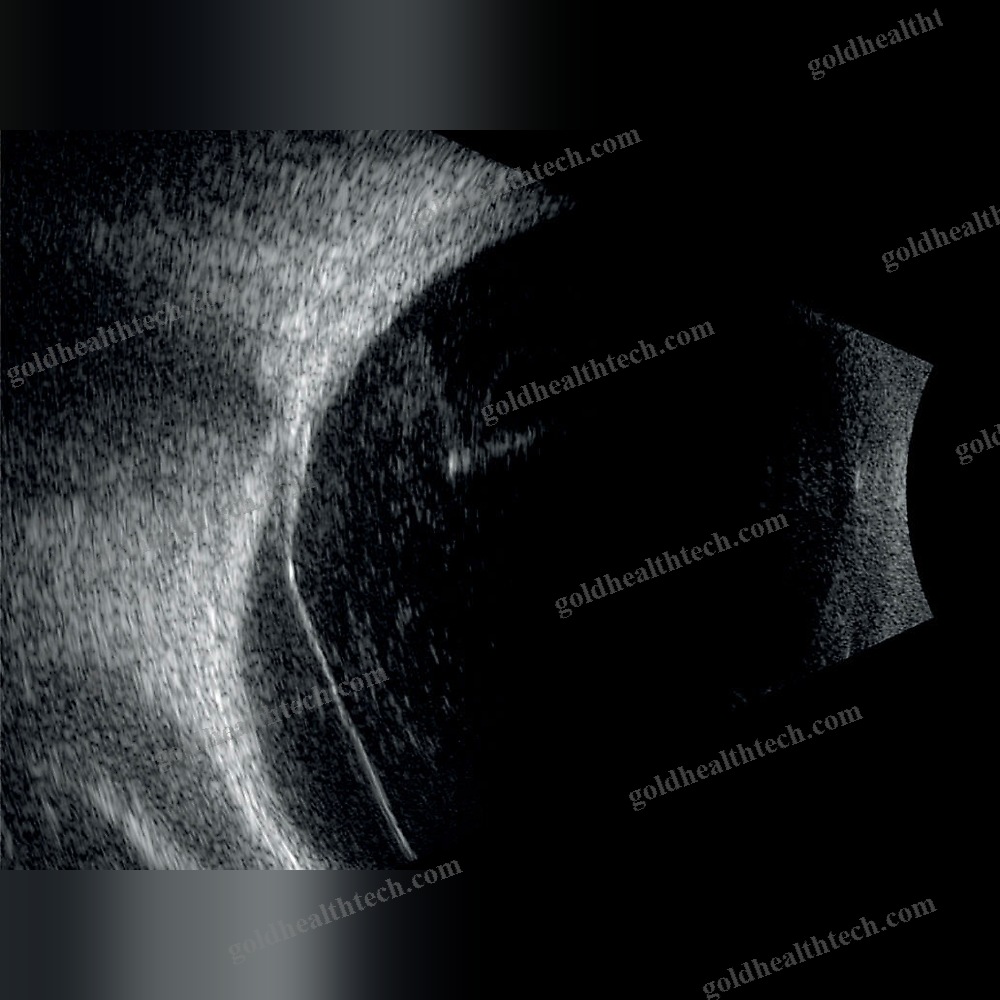 On-Platform, Tabletop Ultrasound System