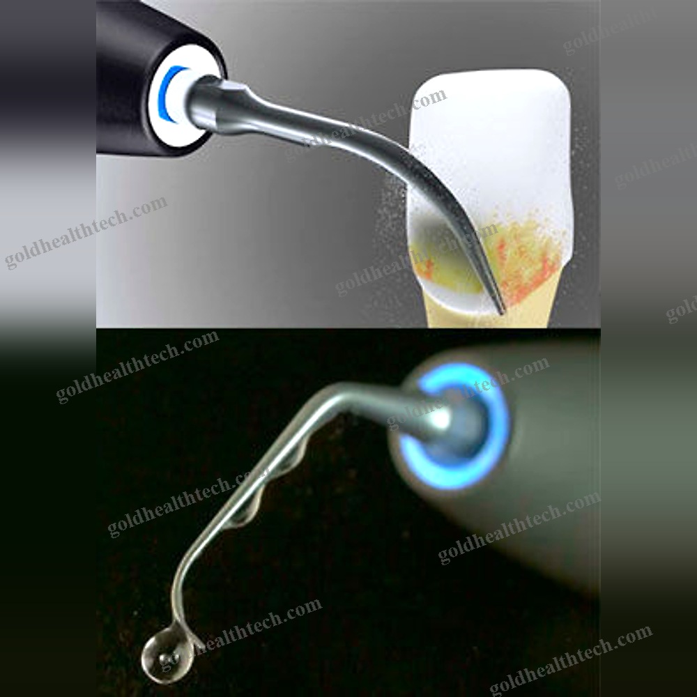 Ultrasonic Dental Scaler