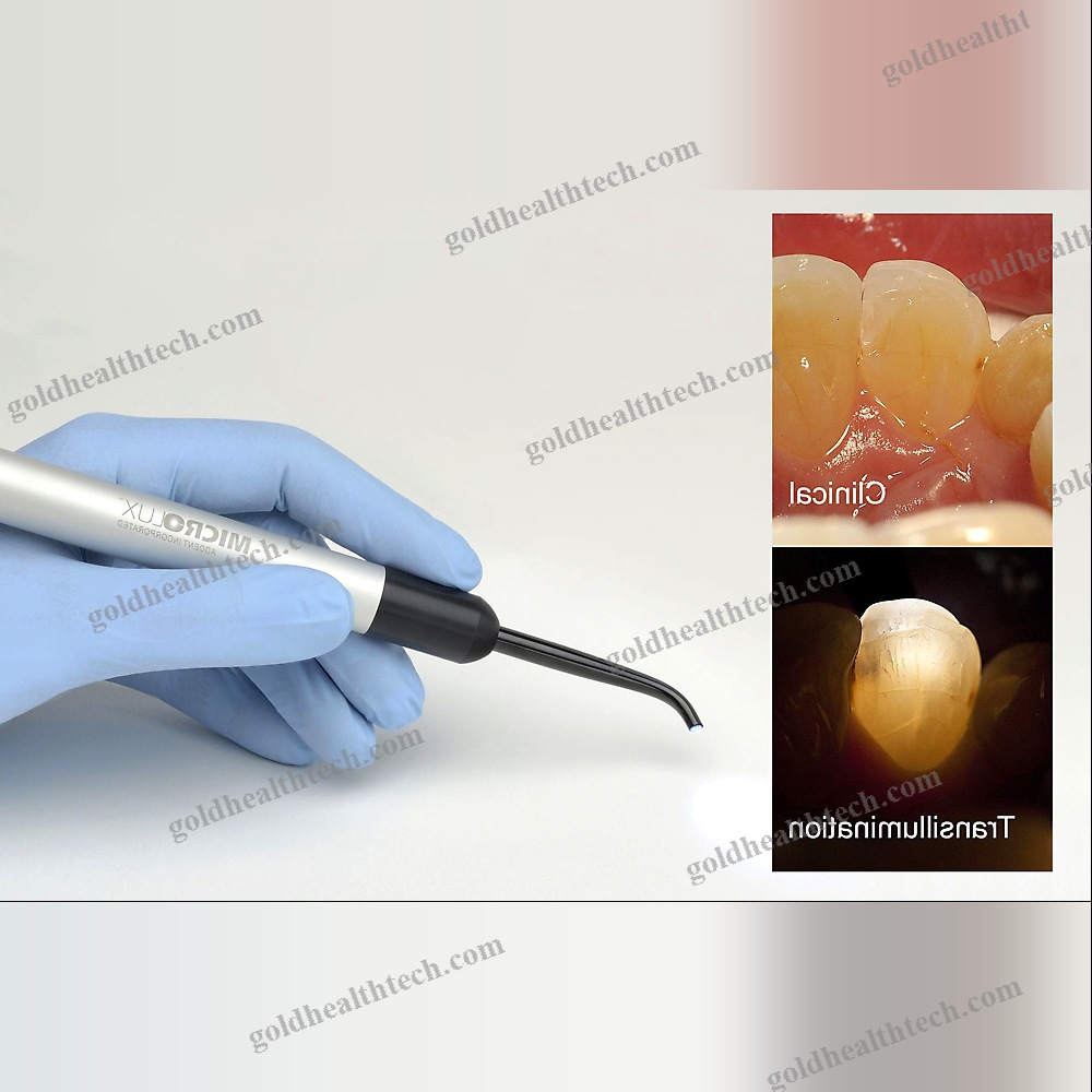 Dental Mirror