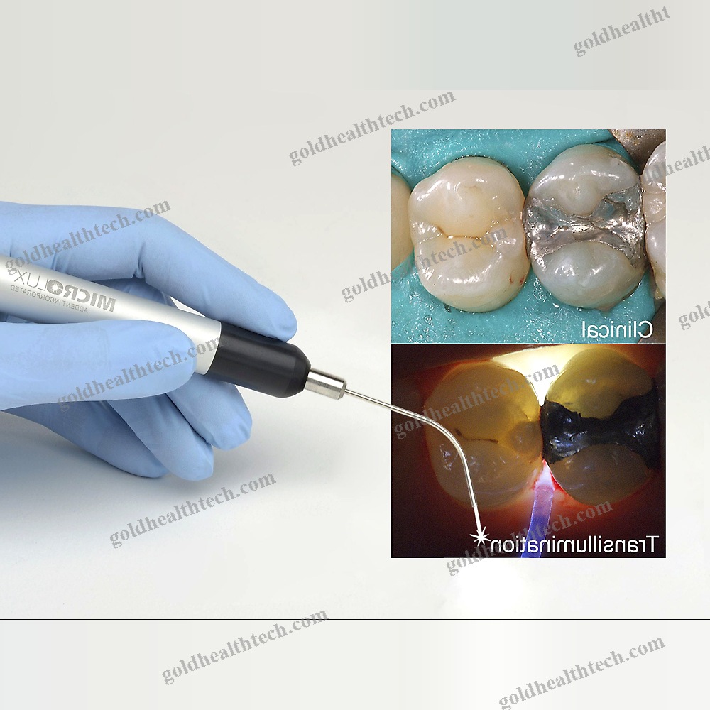 Dental Mirror