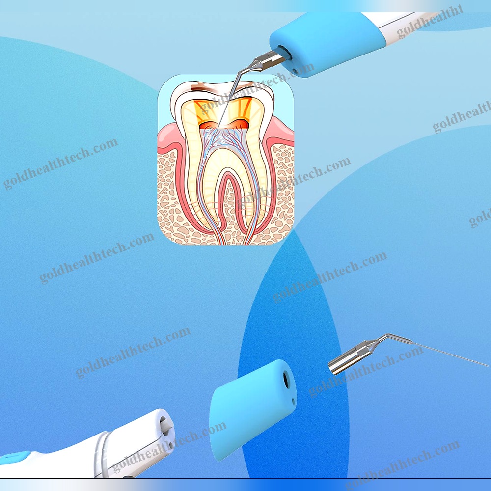 Sonic Root Canal Irrigator