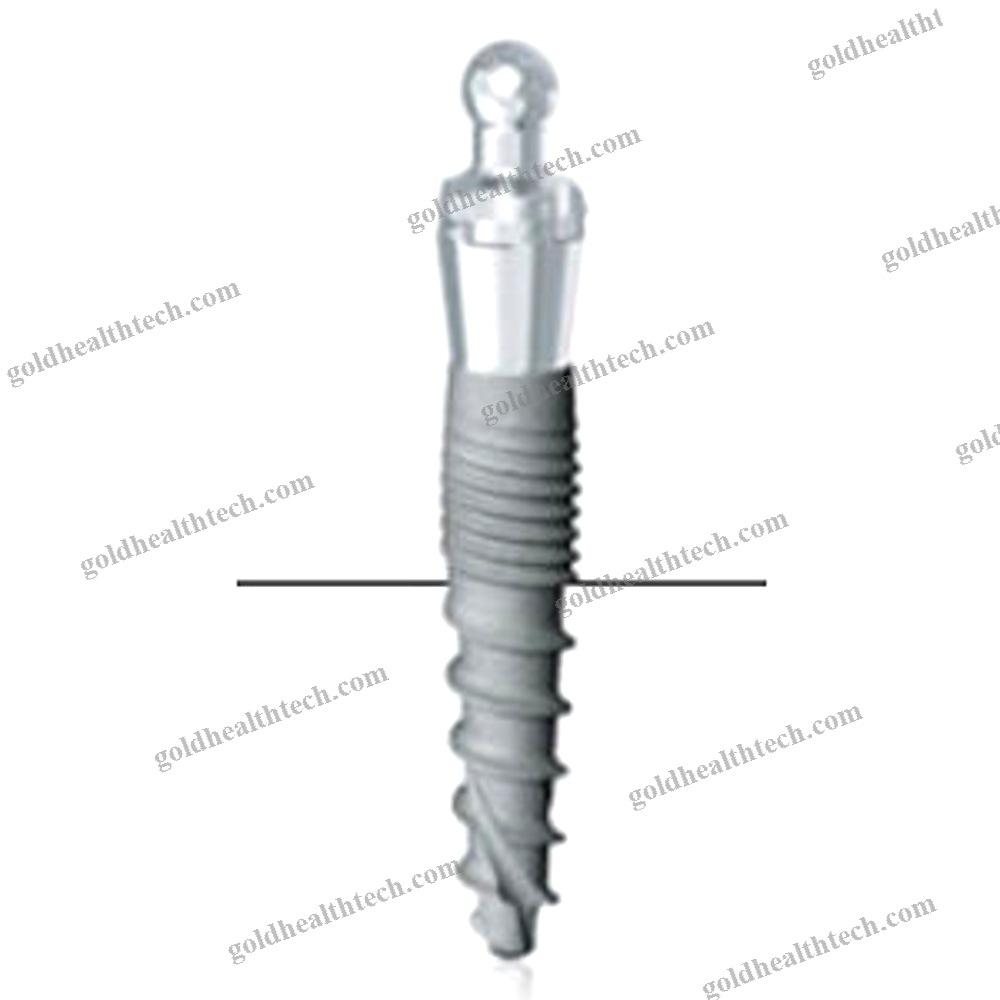 Titanium Dental Implant