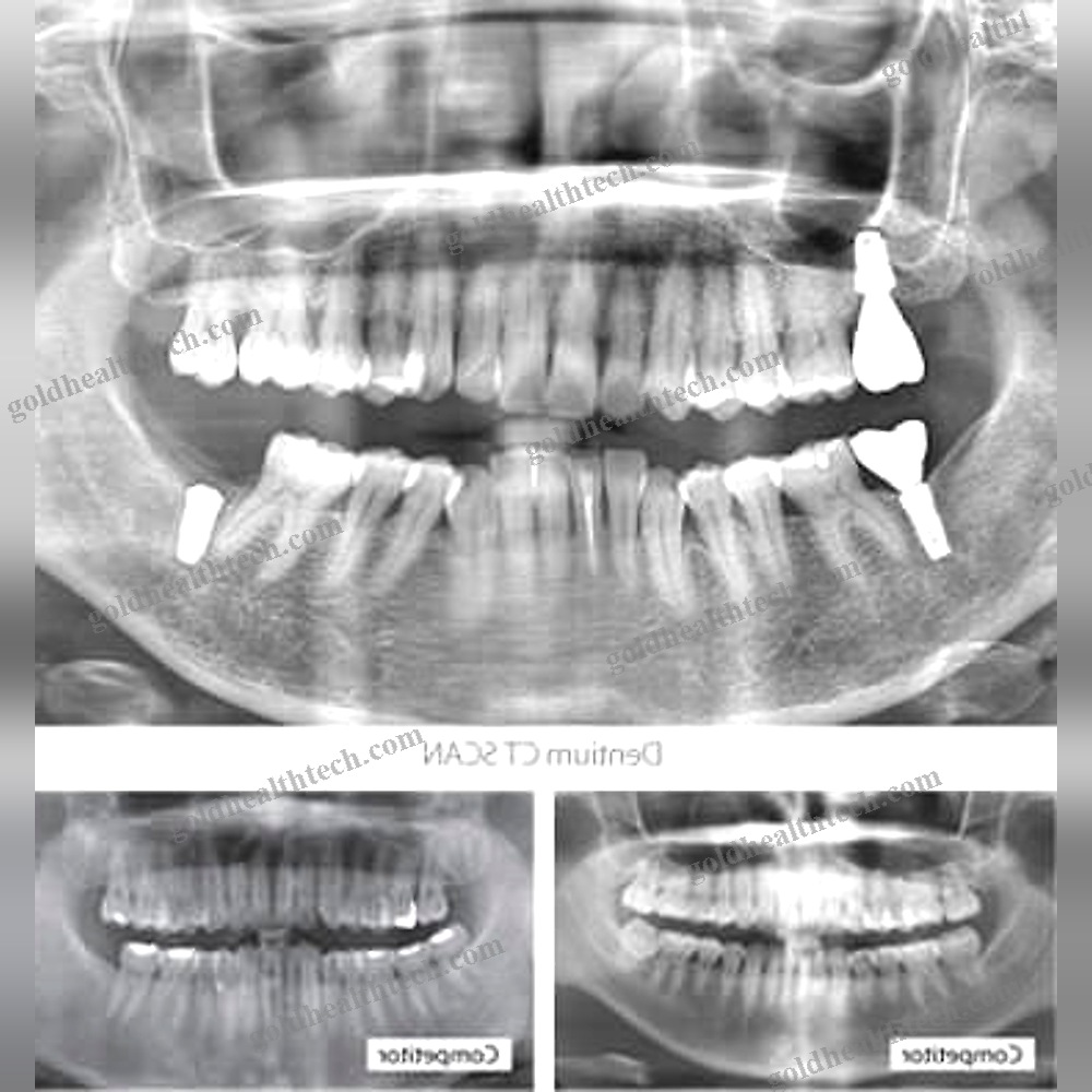 Panoramic X-Ray System