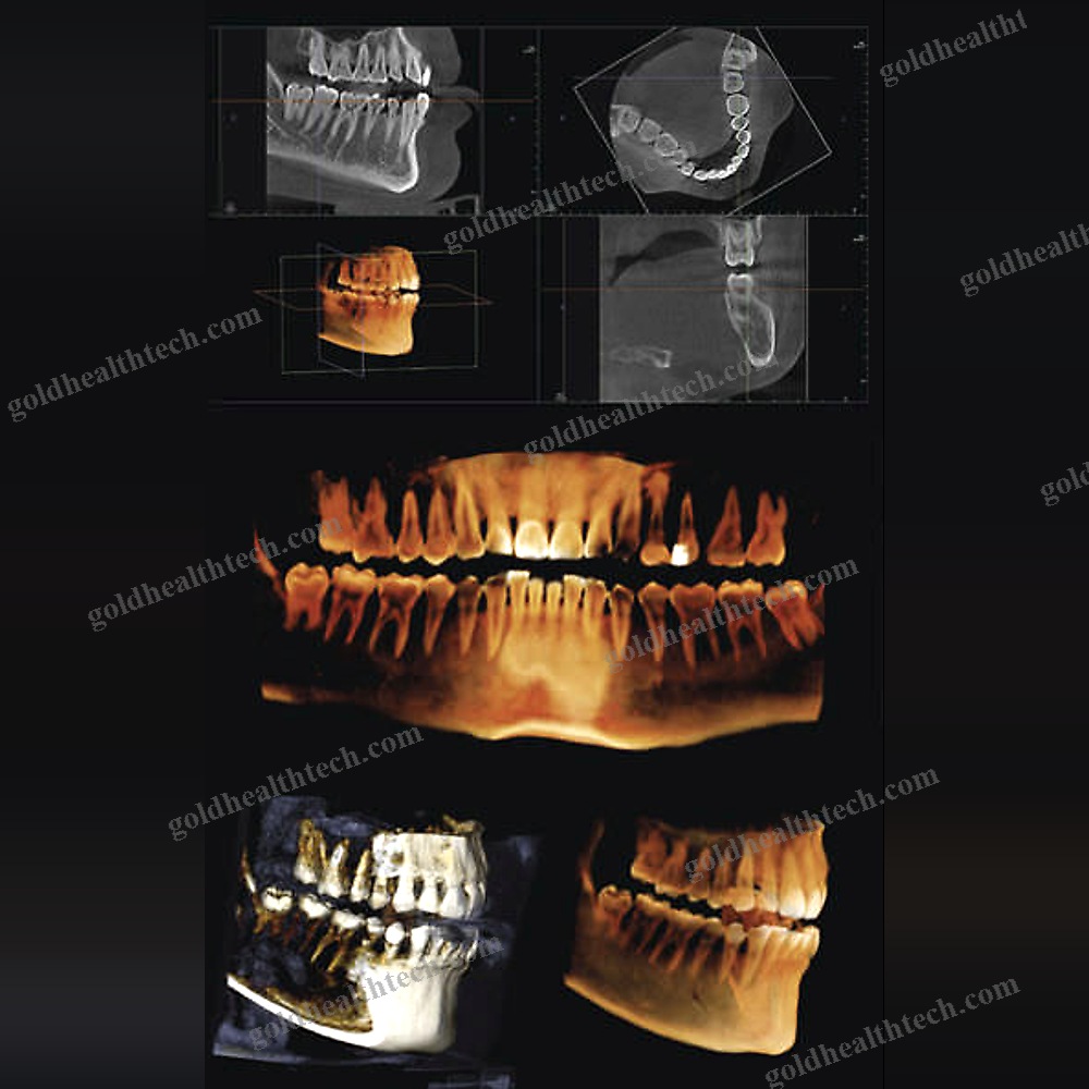 Panoramic X-Ray System