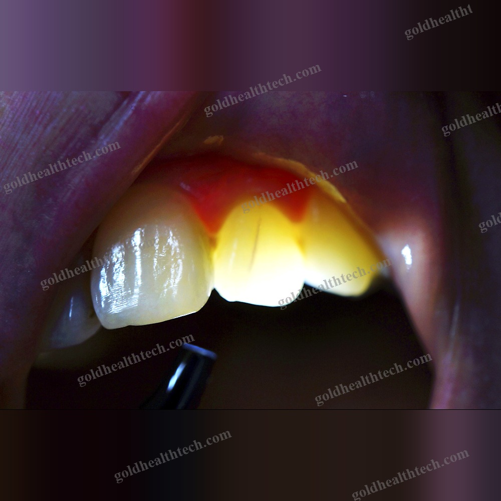 Dental Penlight