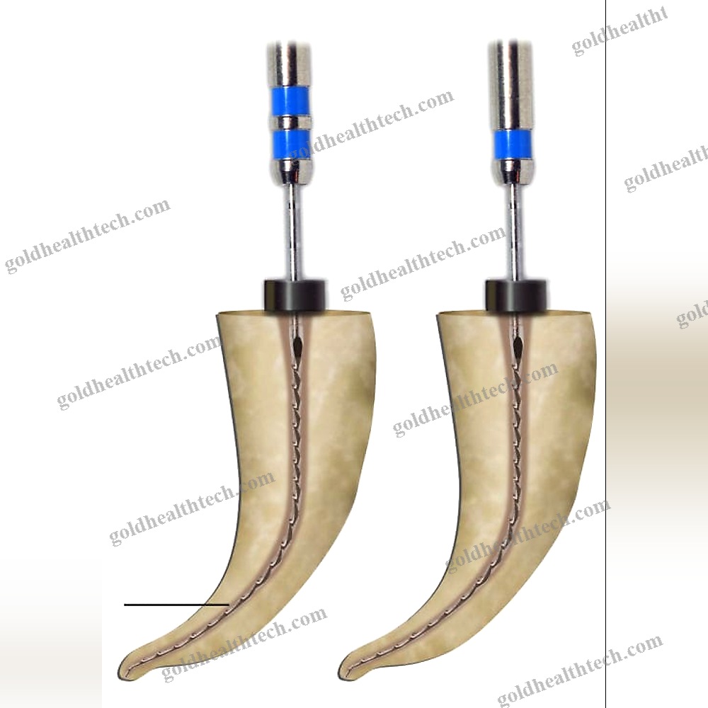 Reciprocating Endodontic File