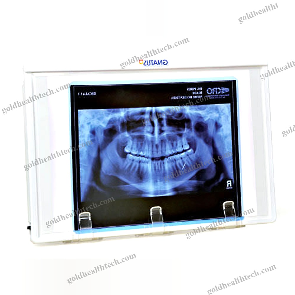 1-Screen X-Ray Film Viewer