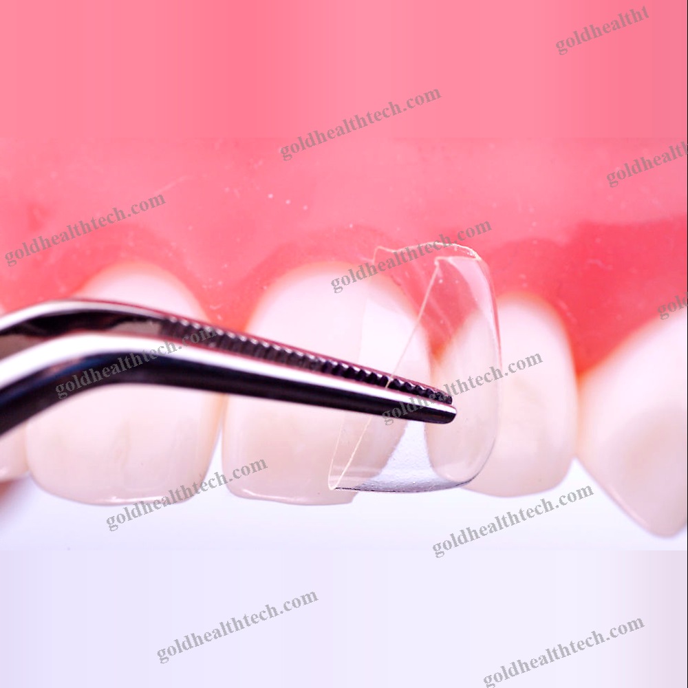 Buccal Tissue Matrix