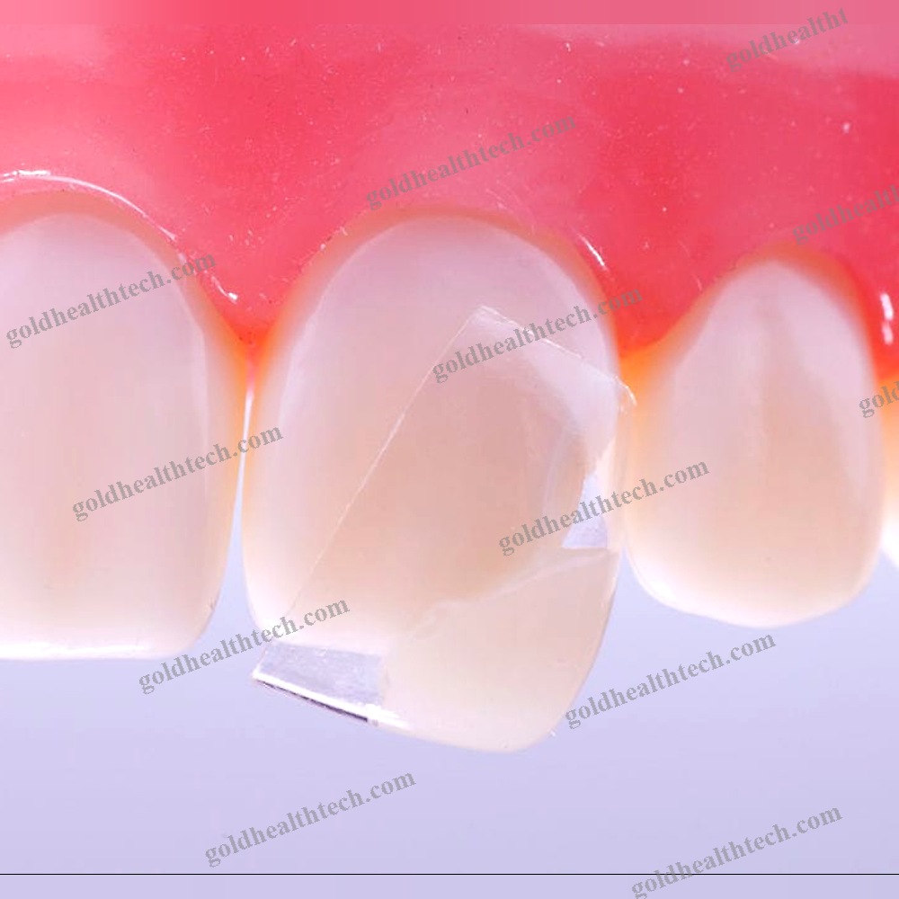 Buccal Tissue Matrix