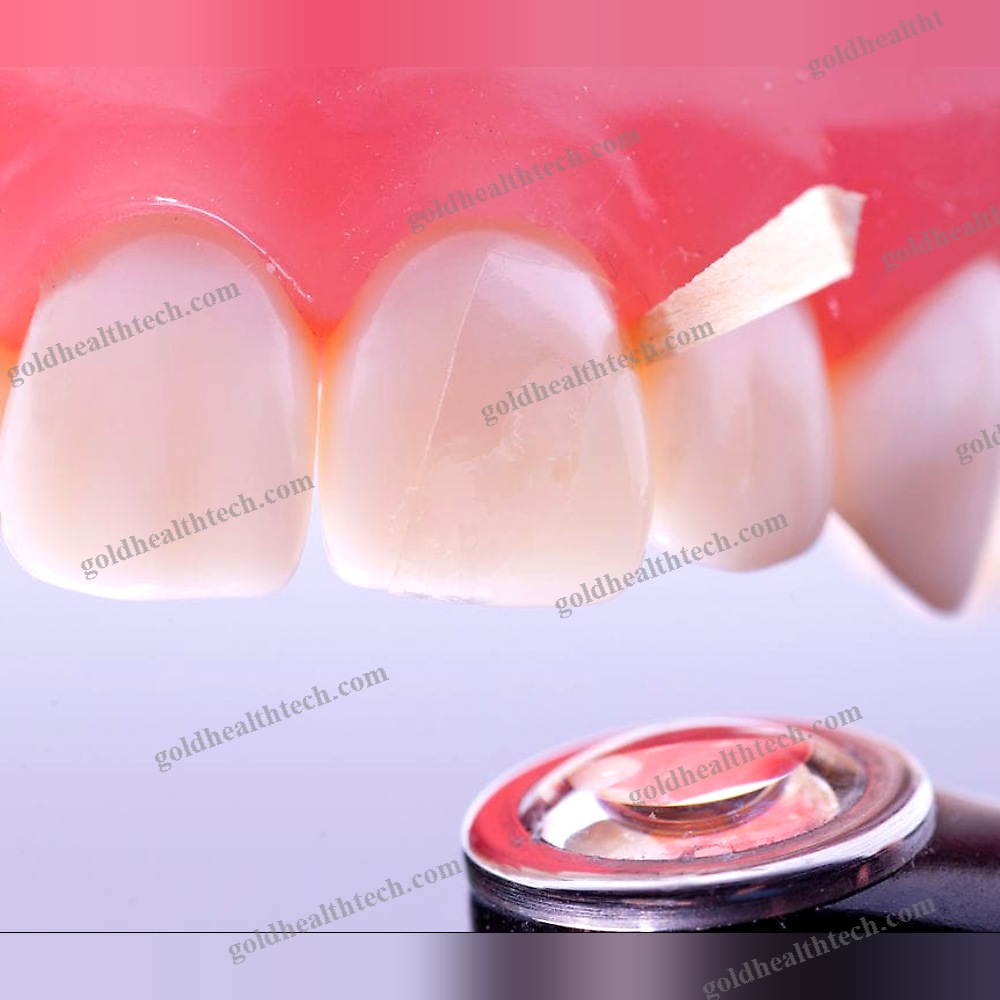 Buccal Tissue Matrix