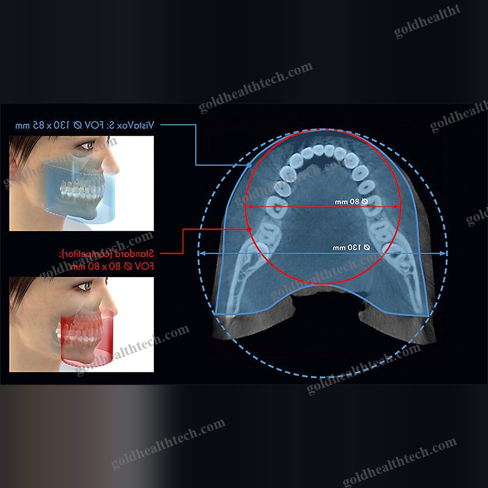 Panoramic X-Ray System