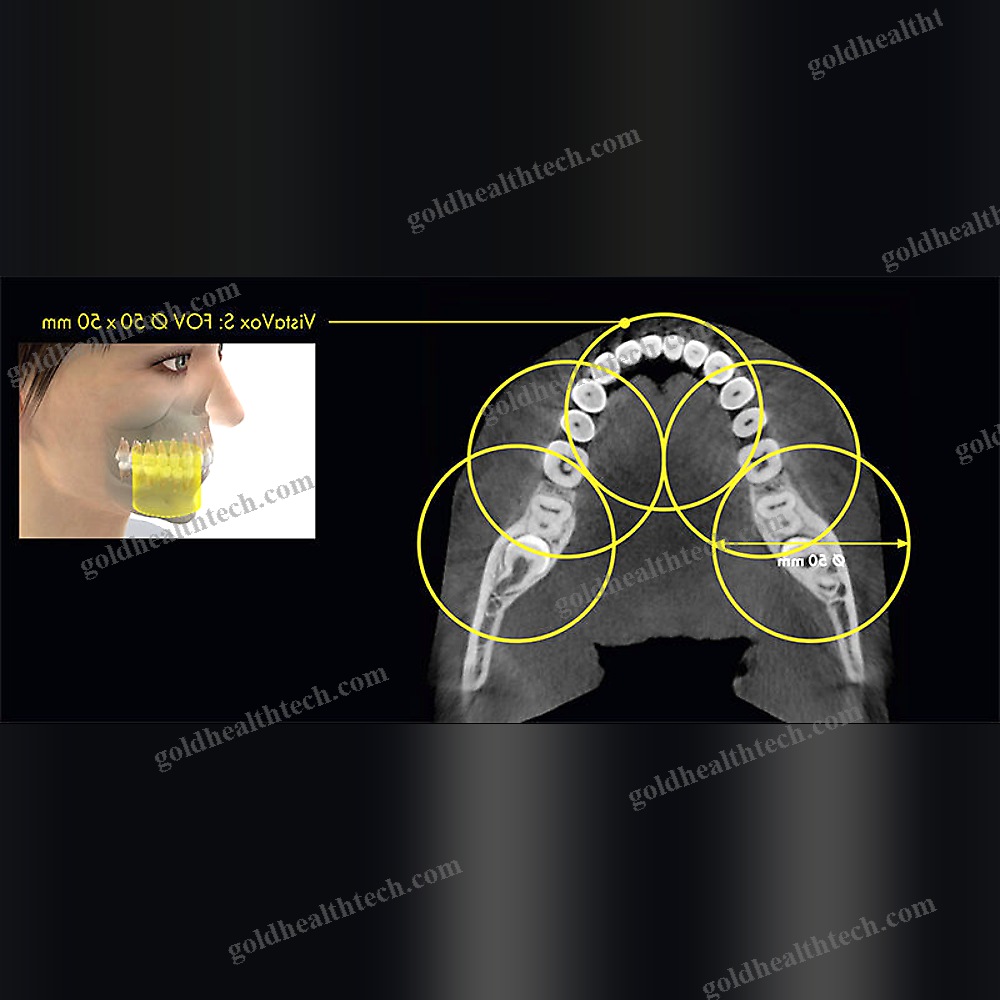 Panoramic X-Ray System