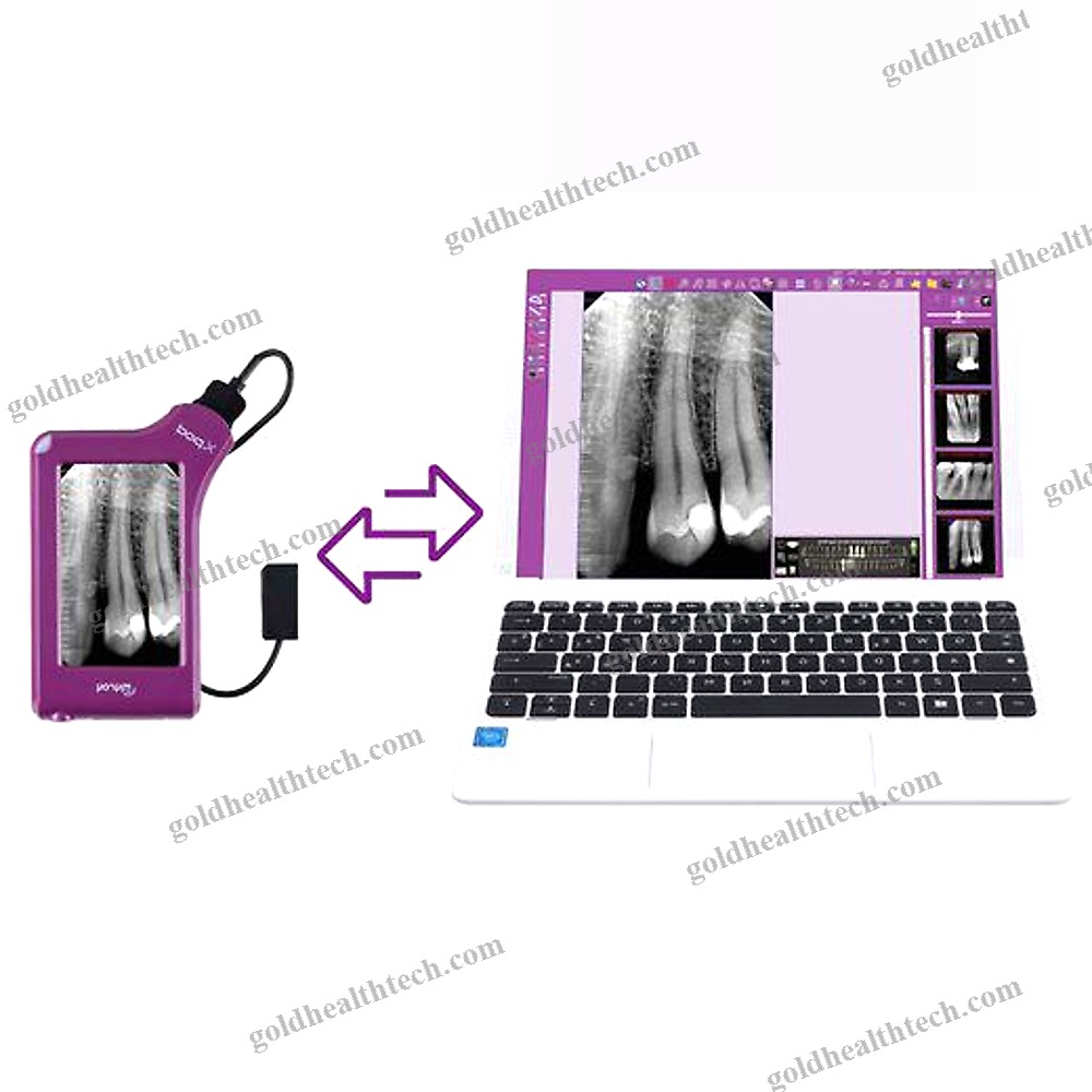 Dental Radiography Acquisition System