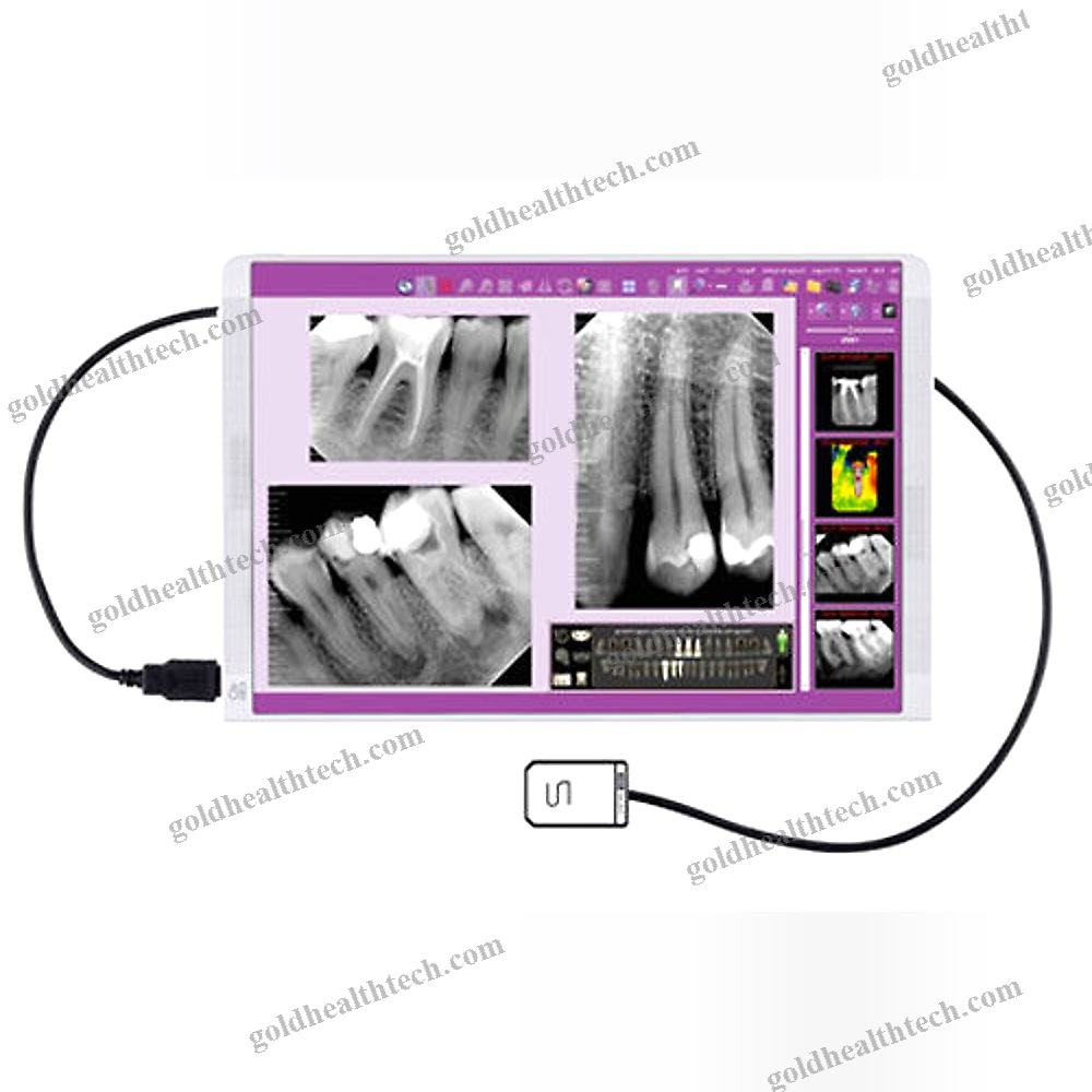 Dental Radiography Intra-Oral Detector