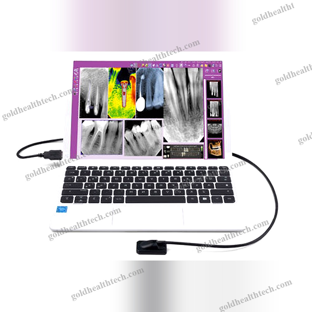 Dental Radiography Intra-Oral Detector